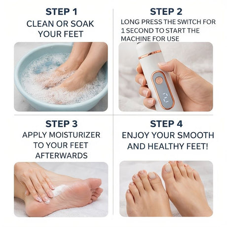 Electric Foot Callus Remover | USB Rechargeable