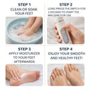 Electric Foot Callus Remover | USB Rechargeable