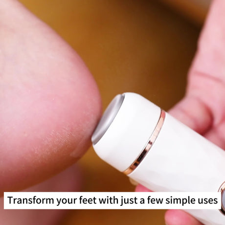 Electric Foot Callus Remover | USB Rechargeable