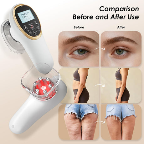 Modern Jingluo Beauty Massager – Electric Meridian Facial & Body Roller with Gentle Suction and Warmth, Multi-Speed Skincare Tool for Relaxing Rituals (White)