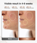 High-Performance 3D LED Beauty Mask – 4 Light Modes, 328 LEDs, Wireless Operation, Adjustable Timer, Lightweight & Flexible Fit – Reveal Radiant Skin (Brown)