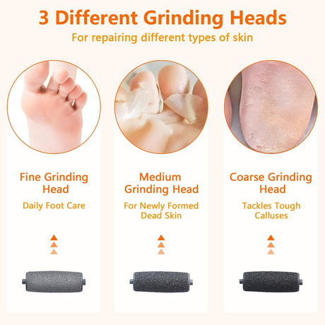 Electric Foot File - Professional Callus Remover - Pack of 10 - 3 Adjustable Speeds - For Dead Skin and Calluses - Pink