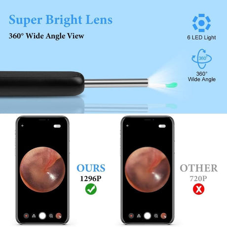 Wireless Smart Ear Cleaner with Camera for Safe Ear Inspection
