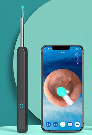 Smart Ear Cleaner with 1296P HD Camera, Wireless Earwax Removal WiFi Endoscope, Safe Inspection Intelligent Temperature Control, Black