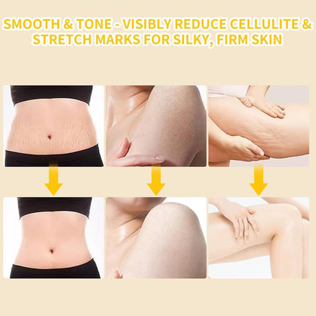 Electric Lymphatic Massager for Deep Cellulite and Body Massage with Display