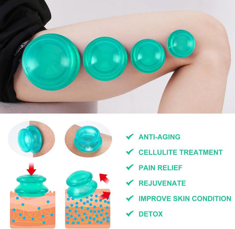 4 pieces silicone cups - Cupping cups - Cupping Set - Cellulite Cups - Cupping For Cellulite - vacuum cup - For reducing cellulite anti-aging relieves pain and joints for buttocks, neck, body - Green