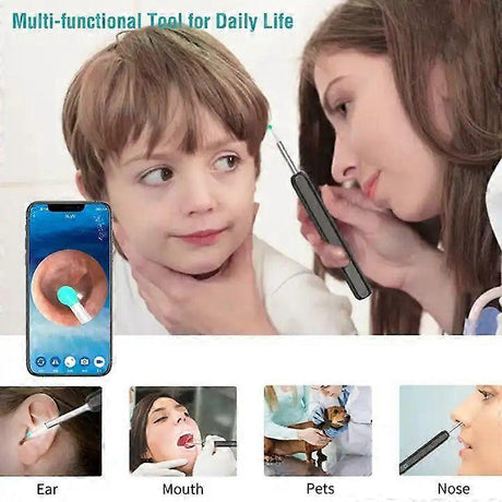 Wireless Smart Visual Ear Cleaner Usb WiFi Otoscope TW1 Ear Wax Removal Tool Set with Camera Ear Endoscope HD 1080P for iPhone iPad Android [db]