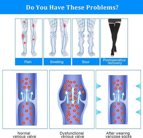 Thigh High Compression Socks for Women Men 23-32 mmHg Open Toe, Level 2 Support for Varicose Veins Edema, Breathable Cotton Spandex with Silicone Dotted Bands