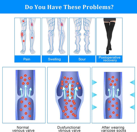 Thigh High Compression Stockings for Women Men 23-32 mmHg Closed Toe, Level 2 Support for Varicose Veins Edema, Breathable Cotton Spandex with Silicone Dotted Bands