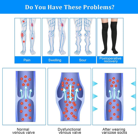 Thigh High Compression Socks for Women Men 15-21 mmHg Closed Toe, Level 1 Support for Edema Pregnancy, Breathable Polyester with Non-Slip Cuffs for All-Day Wear