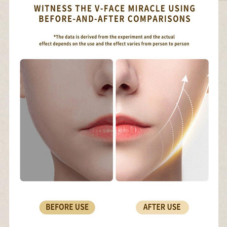 Intelligent Electric Double Chin and V-Shaped Face Machine with 12Adjustable Intensities - Women's V-Face Machine(white,25.6*4.5cm）