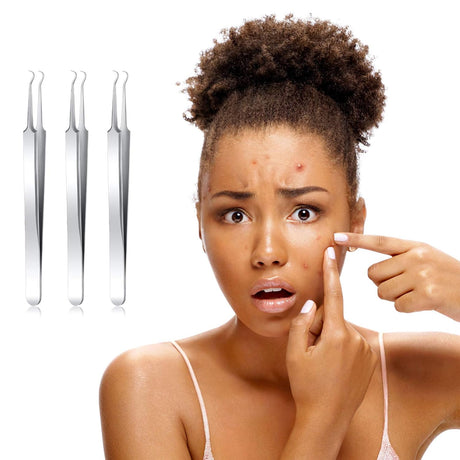 3 Pcs Blackhead Tweezer Stainless Steel Pimple Tweezers Extractor Tool for Remove Zit Whitehead Pimple Bend Curved Tweezer Skin Blackhead Remover Tools(Silver)
