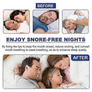 Anti-snoring Tape Nasal Breathing Stickers Anti-opening Snoring Breathing