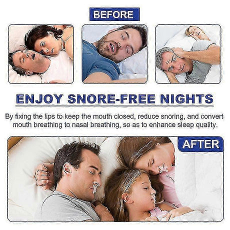 Anti-snoring Tape Nasal Breathing Stickers Anti-opening Snoring Breathing