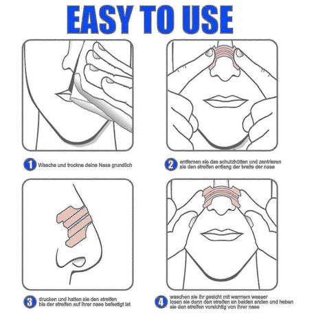Nasal Strips For Snore Relief - Breathe Better, Sleep Better, 55mm X 16mm
