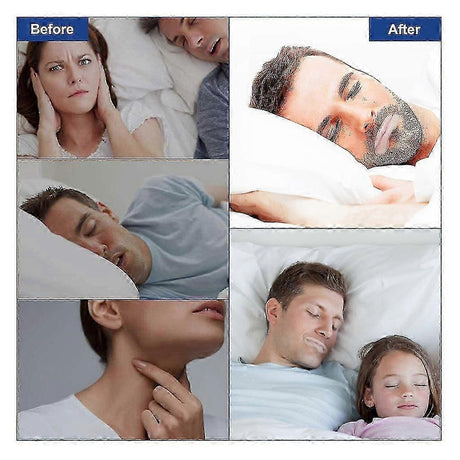 Sleep Strips Mouth Tape For Better Breathing Relief