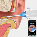 2pcs Ear Wax Removal Visual Ear Cleaner Tool Kit Ear Cleaning Scope Set-White