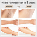 Laser Hair Removal, BoSidin IPL Hair Removal with Painless Ice-Cooling, 2-in-1 Face SR Rejuvenation, 6+1 Modes, 6 Levels Hair Removal for Women Permanent, Laser Hair Removal Kit with Shaver, Goggles