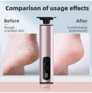 Purple Rechargeable Electric Foot File with 9 Speed Settings - Callus Remover for Smooth Feet
