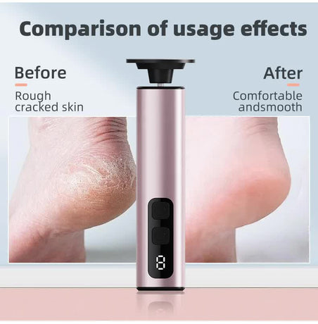 Purple Rechargeable Electric Foot File with 9 Speed Settings - Callus Remover for Smooth Feet