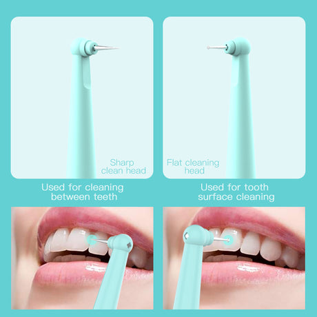 Intelligent High-Frequency Vibration Dental Calculus & Stain Remover(black)