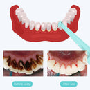 Intelligent High-Frequency Vibration Dental Calculus & Stain Remover(black)