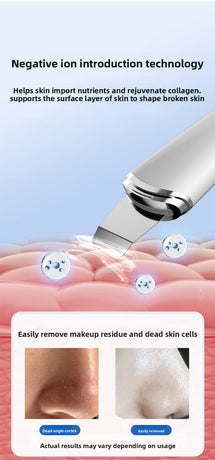 Ultrasonic Skin Scrubber Facial Spatula Blackhead Remover & Pore Cleaner with Ion EMS Lifting Mode Rechargeable Beauty Tool Black