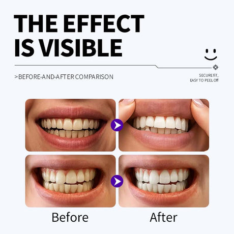 Professional Enamel-Safe Teeth Whitening Strips(12 Strips per Pack) - Antibacterial Gum Care & Deep Cleaning