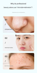 White Heated Micro-Bubble Blackhead Remover Vacuum Pore Cleaner - 46C Hot Compress Electric Water Cycle Facial Cleansing Device with 6 Suction Heads 3 Modes