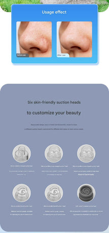 White Heated Micro-Bubble Blackhead Remover Vacuum Pore Cleaner - 46C Hot Compress Electric Water Cycle Facial Cleansing Device with 6 Suction Heads 3 Modes